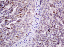 PCNA Antibody in Immunohistochemistry (Paraffin) (IHC (P))