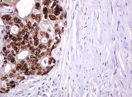 PCNA Antibody in Immunohistochemistry (Paraffin) (IHC (P))