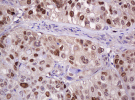 PCNA Antibody in Immunohistochemistry (Paraffin) (IHC (P))