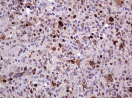 PCNA Antibody in Immunohistochemistry (Paraffin) (IHC (P))