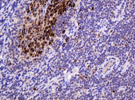 PCNA Antibody in Immunohistochemistry (Paraffin) (IHC (P))