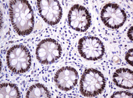 PCNA Antibody in Immunohistochemistry (Paraffin) (IHC (P))