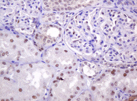 PCNA Antibody in Immunohistochemistry (Paraffin) (IHC (P))