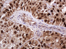 PCNA Antibody in Immunohistochemistry (Paraffin) (IHC (P))