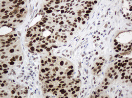 PCNA Antibody in Immunohistochemistry (Paraffin) (IHC (P))