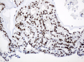 PCNA Antibody in Immunohistochemistry (Paraffin) (IHC (P))