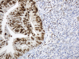 PCNA Antibody in Immunohistochemistry (Paraffin) (IHC (P))