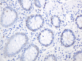 PCNA Antibody in Immunohistochemistry (Paraffin) (IHC (P))