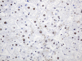 PCNA Antibody in Immunohistochemistry (Paraffin) (IHC (P))