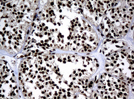 PCNA Antibody in Immunohistochemistry (Paraffin) (IHC (P))