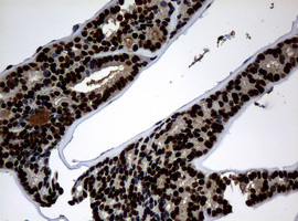 PCNA Antibody in Immunohistochemistry (Paraffin) (IHC (P))