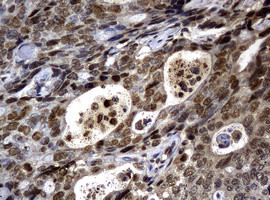 PCNA Antibody in Immunohistochemistry (Paraffin) (IHC (P))