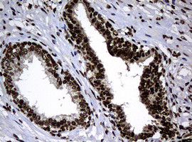 PCNA Antibody in Immunohistochemistry (Paraffin) (IHC (P))