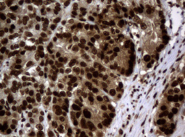 PCNA Antibody in Immunohistochemistry (Paraffin) (IHC (P))