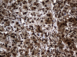 PCNA Antibody in Immunohistochemistry (Paraffin) (IHC (P))