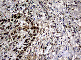 PCNA Antibody in Immunohistochemistry (Paraffin) (IHC (P))