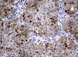 PCNA Antibody in Immunohistochemistry (Paraffin) (IHC (P))