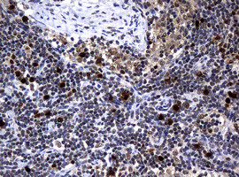 PCNA Antibody in Immunohistochemistry (Paraffin) (IHC (P))