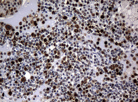 PCNA Antibody in Immunohistochemistry (Paraffin) (IHC (P))