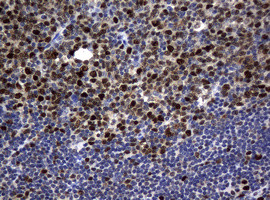 PCNA Antibody in Immunohistochemistry (Paraffin) (IHC (P))