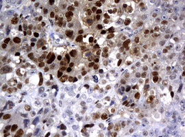 PCNA Antibody in Immunohistochemistry (Paraffin) (IHC (P))