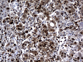 PCNA Antibody in Immunohistochemistry (Paraffin) (IHC (P))