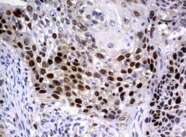 PCNA Antibody in Immunohistochemistry (Paraffin) (IHC (P))