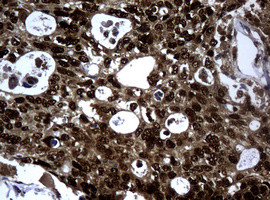 PCNA Antibody in Immunohistochemistry (Paraffin) (IHC (P))