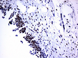 PCNA Antibody in Immunohistochemistry (Paraffin) (IHC (P))