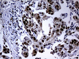 PCNA Antibody in Immunohistochemistry (Paraffin) (IHC (P))