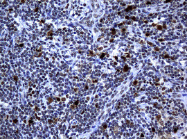 PCNA Antibody in Immunohistochemistry (Paraffin) (IHC (P))