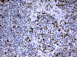 PCNA Antibody in Immunohistochemistry (Paraffin) (IHC (P))