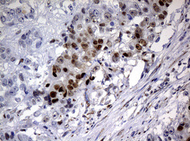 PCNA Antibody in Immunohistochemistry (Paraffin) (IHC (P))