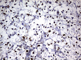 PCNA Antibody in Immunohistochemistry (Paraffin) (IHC (P))