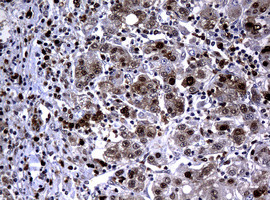 PCNA Antibody in Immunohistochemistry (Paraffin) (IHC (P))