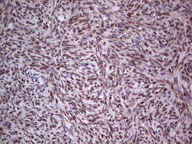 PCNA Antibody in Immunohistochemistry (Paraffin) (IHC (P))