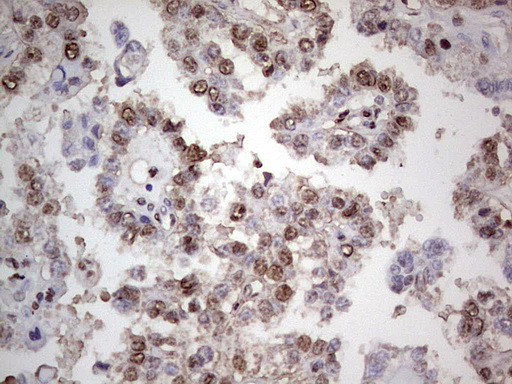 PCNA Antibody in Immunohistochemistry (Paraffin) (IHC (P))