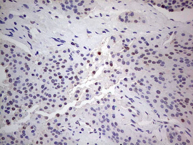 PCNA Antibody in Immunohistochemistry (Paraffin) (IHC (P))