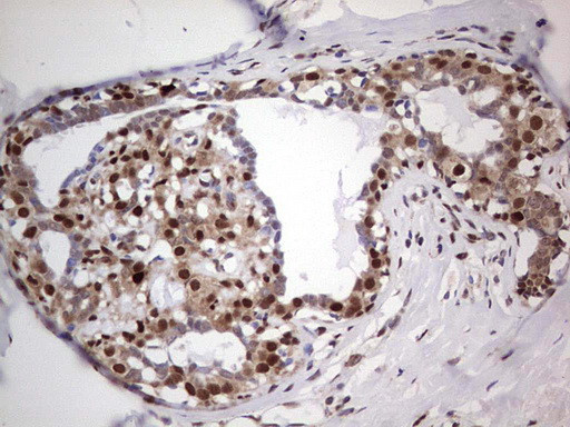 PCNA Antibody in Immunohistochemistry (Paraffin) (IHC (P))