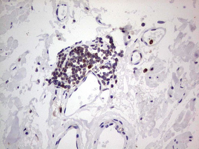 PCNA Antibody in Immunohistochemistry (Paraffin) (IHC (P))