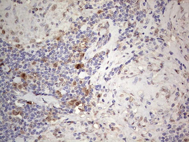 PCNA Antibody in Immunohistochemistry (Paraffin) (IHC (P))