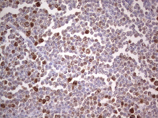 PCNA Antibody in Immunohistochemistry (Paraffin) (IHC (P))