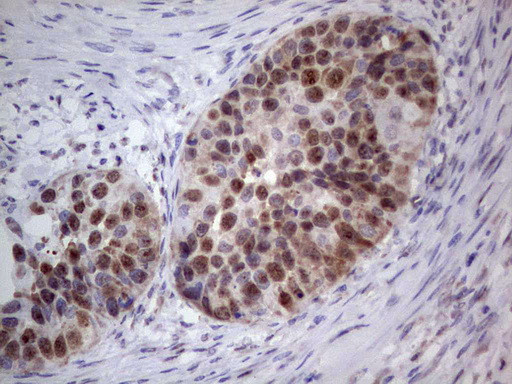 PCNA Antibody in Immunohistochemistry (Paraffin) (IHC (P))