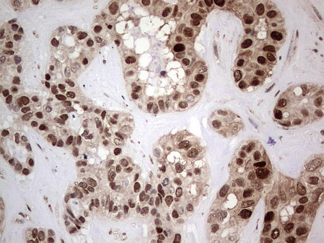 PCNA Antibody in Immunohistochemistry (Paraffin) (IHC (P))