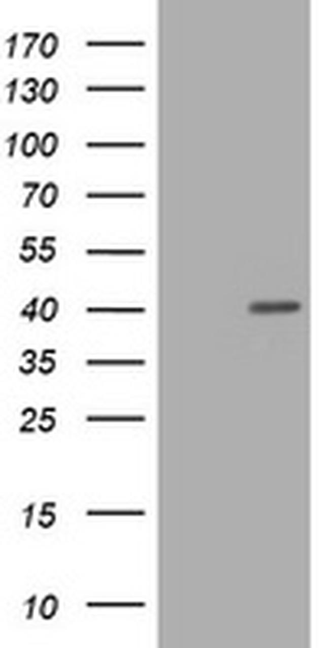 PCNA Antibody in Western Blot (WB)