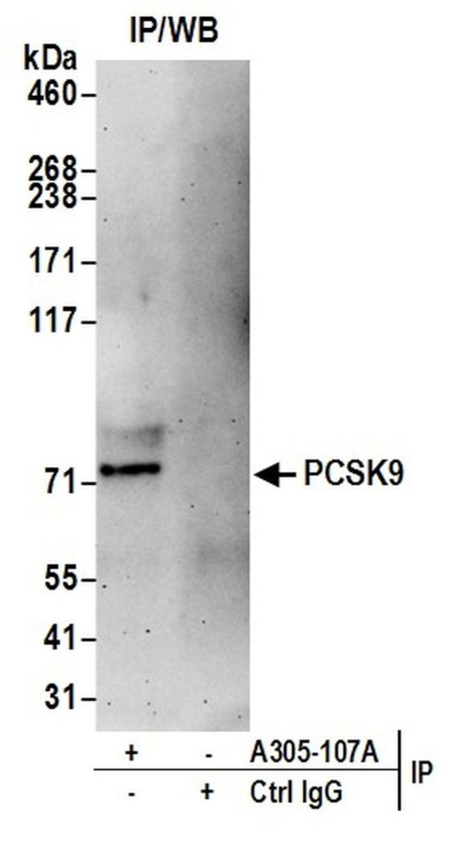 PCSK9 Antibody in Immunoprecipitation (IP)