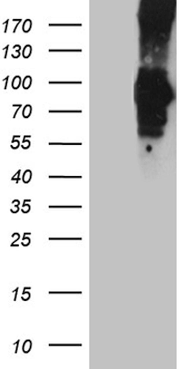 PCSK9 Antibody in Western Blot (WB)