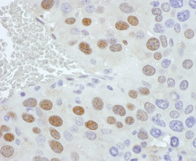 PCYT1A Antibody in Immunohistochemistry (IHC)