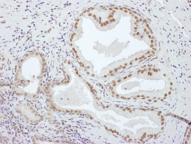 PCYT1A Antibody in Immunohistochemistry (IHC)