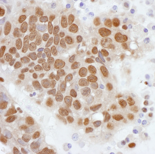 PCYT1A Antibody in Immunohistochemistry (IHC)
